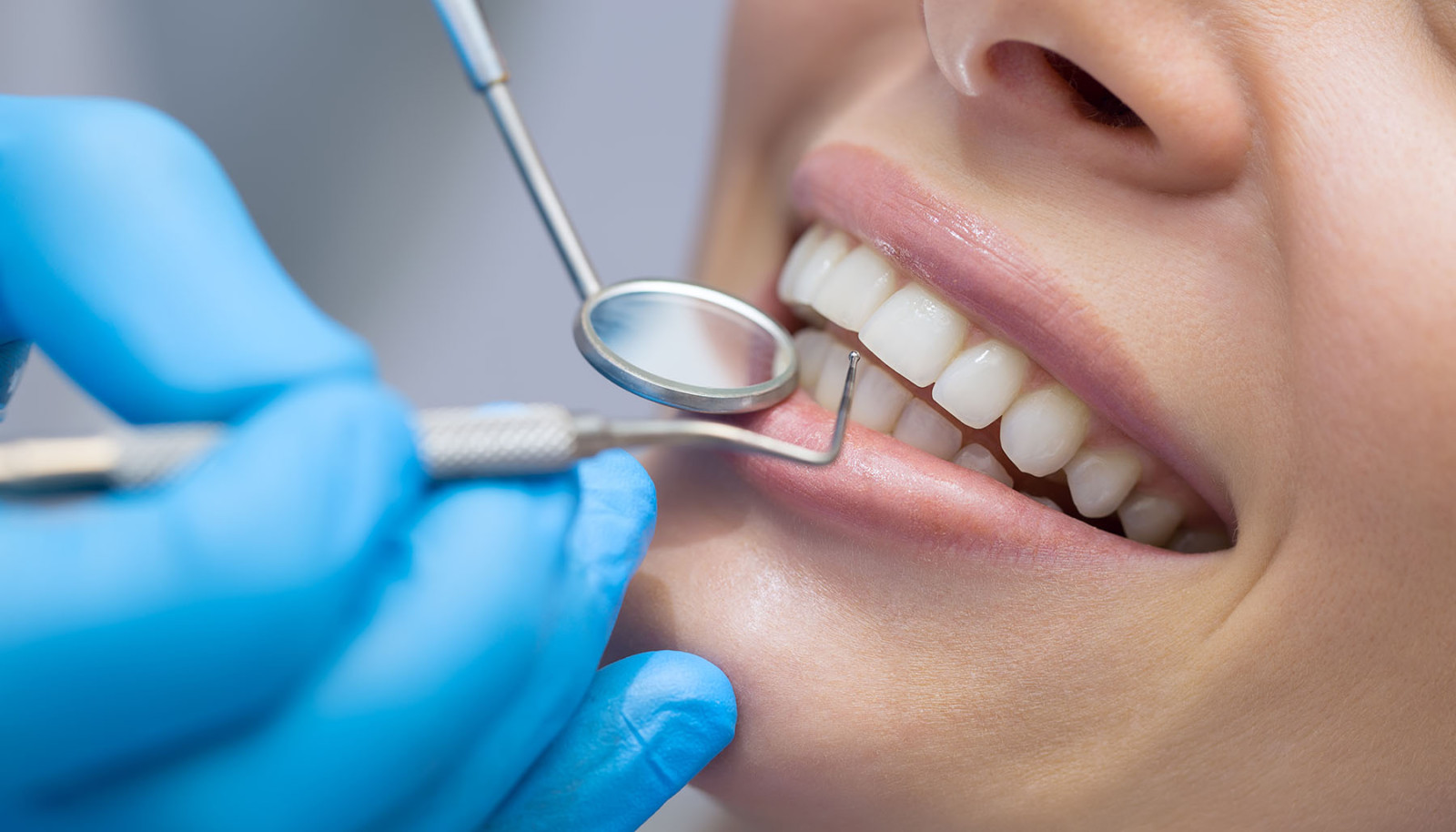 Cosmetische Tandheelkunde 1: Facings En Stralend Witte Tanden